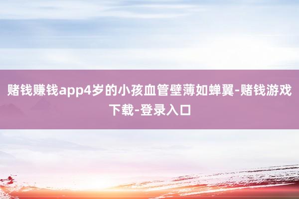 赌钱赚钱app4岁的小孩血管壁薄如蝉翼-赌钱游戏下载-登录入口