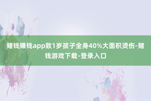 赌钱赚钱app致1岁孩子全身40%大面积烫伤-赌钱游戏下载-登录入口